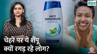  Does Anti-Dandruff shampoo cure acne? Doctor explains 