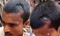 Nawada head stapler Pins stitches video