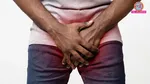 tight foreskin or phimosis causes symptoms prevention & treatment 