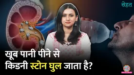 related-article-banner-image