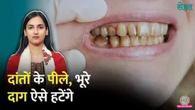 related-article-banner-image