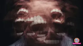 related-article-banner-image