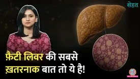 related-article-banner-image