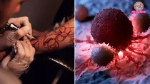 can tattoo increase risk of cancer expert opinion