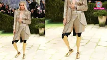 Met Gala 2026: Toxic Shock Syndrome survivor Lauren Wasser debuts gold prosthetic legs