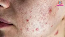Four skincare mistakes that may be damaging your skin