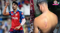 ipl player shashank singh FIR