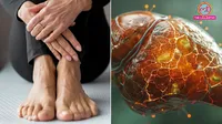what are the warning signs of liver damage in legs