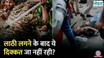 how serious can injuries caused by a lathi be & which parts of the body are most vulnerable