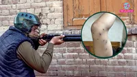 Delhi raf fire pellet gun in jantar mantar protest