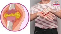 who is at the highest risk of developing high uric acid & how can it be controlled