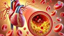sehat lallantop ldl cholesterol diet what to eat and avoid