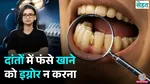 always getting food stuck in teeth problems sehat
