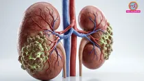 which common medical conditions can increase the risk of kidney failure