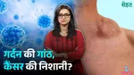 lymphoma causes symptoms & treatment in hindi 