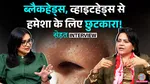 how to remove tanning from face and hands sehat
