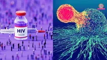 HIV Cure research Immune therapy