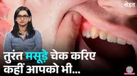 Home Remedies for Swollen Gums sehat