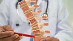 Why do bones become hollow & how to prevent osteoporosis