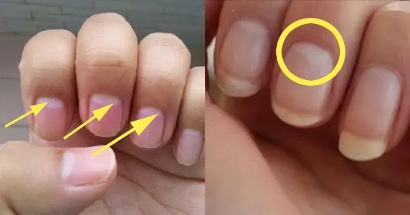 can i use milky white for french tip｜TikTok Search