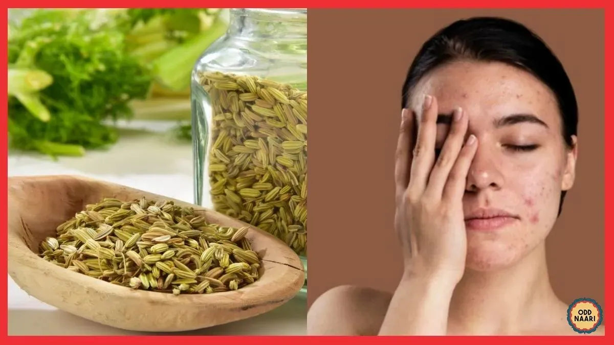 स्किन पर दाने होते हैं? सौंफ की ये ट्रिक अपनाइए, चेहरा एकदम साफ हो