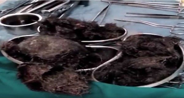 Source: Youtube Screengrab