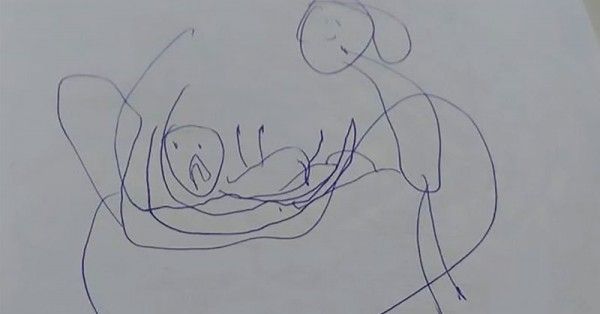 child-abuse