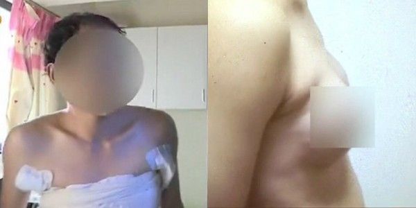 male breasts 1