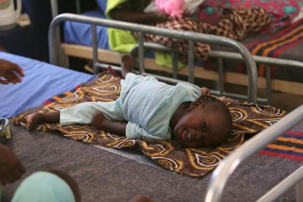 A child who is suffering brain damage resulting from Cerebral Spinal Meningitis is seen at the Save the Children stabilisation ward in Maiduguri, Nigeria November 30, 2016. Picture taken November 30, 2016. REUTERS/Afolabi Sotunde