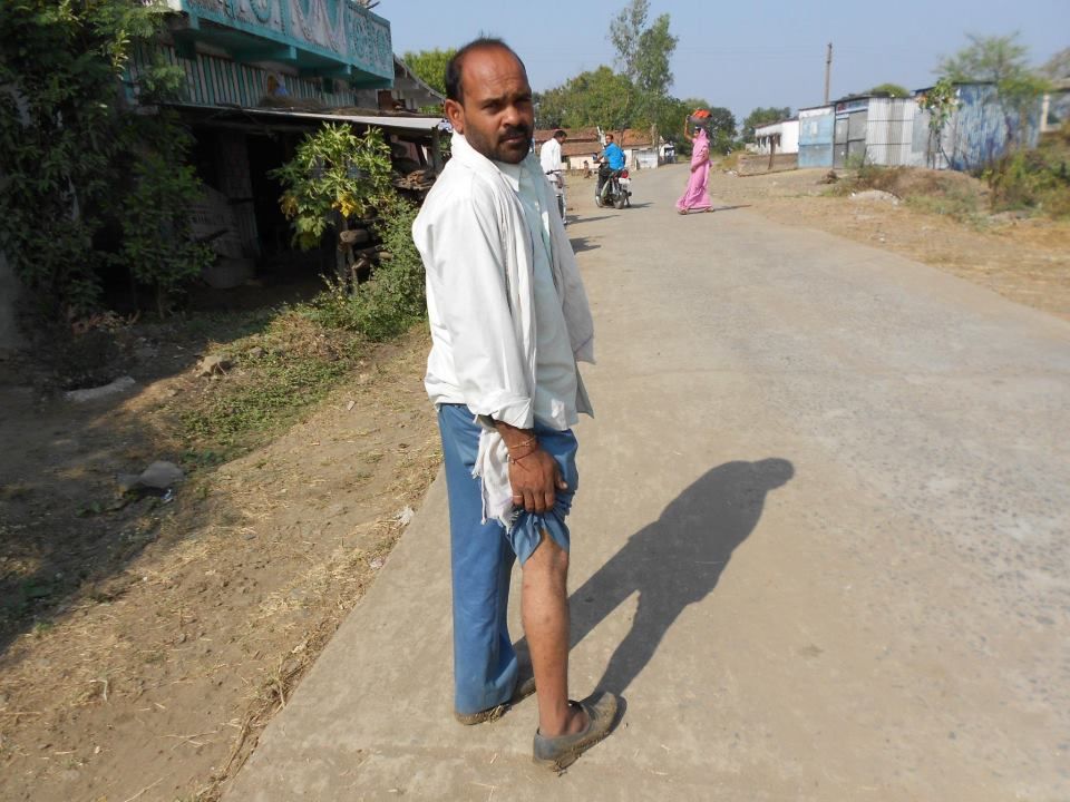 यह फोटो परमंडल गांव के रहने वाले एक युवा की है, जो 12 जनवरी की गोलीकांड में घायल हो गया था. तस्वीर Abhishek Ranjan Singh की फेसबुक प्रोफाइल से ली गई है. 