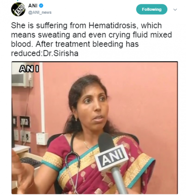 hematidrosis