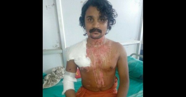 जून में नारायणन पर एसिड अटैक किया गया था.
