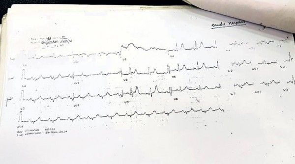 डांडे अस्पताल से मिली इसीजी रिपोर्ट. (फोटो- इंडियन एक्सप्रेस)