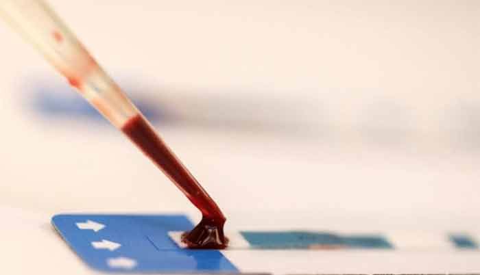 जब खून की जांच हुई, तो मालूम चला कि उसे एड्स है. ये खबर गांव में फैल गई. जितने भी लोगों ने मदद के बहाने उसके साथ सेक्स किया था, सबने अपना-अपना टेस्ट कराया. तेरह लोग एचआईवी पॉजीटिव पाए गए.