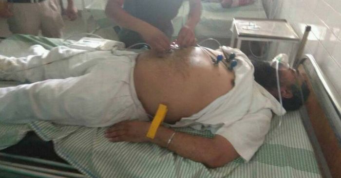 मारपीट के बाद अस्पताल में भर्ती विधायक.
