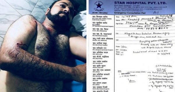 काश़िफ फिलहाल अस्पताल में भर्ती हैं, जहां उनकी हालत गंभीर बनी हुई है.