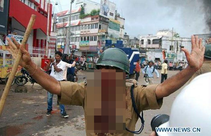 ये अगरतला की फोटो है. 2011 में यहां त्रिपुरा पुलिस और कांग्रेस कार्यकर्ताओं के बीच झड़प हुई. इसी घटना में घायल एक पुलिसकर्मी की फोटो है ये (फोटो: CNTV)
