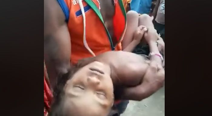 बच्ची के पिता विडियो में मेजरगंज रेफरल अस्पताल के डॉक्टरों पर लापरवाही का इल्जाम लगा रहे हैं. स्थानीय पुलिस ने भी यही कहा है. न केवल इलाज में लापरवाही बरती गई, बल्कि ऐम्बुलेंस जैसी जरूरी चीज भी नहीं मुहैया कराई गई. पिता का कहना है कि बच्ची करीब 40 मिनट तक जिंदा थी. अगर कोशिश की जाती, तो वो बच सकती थी.