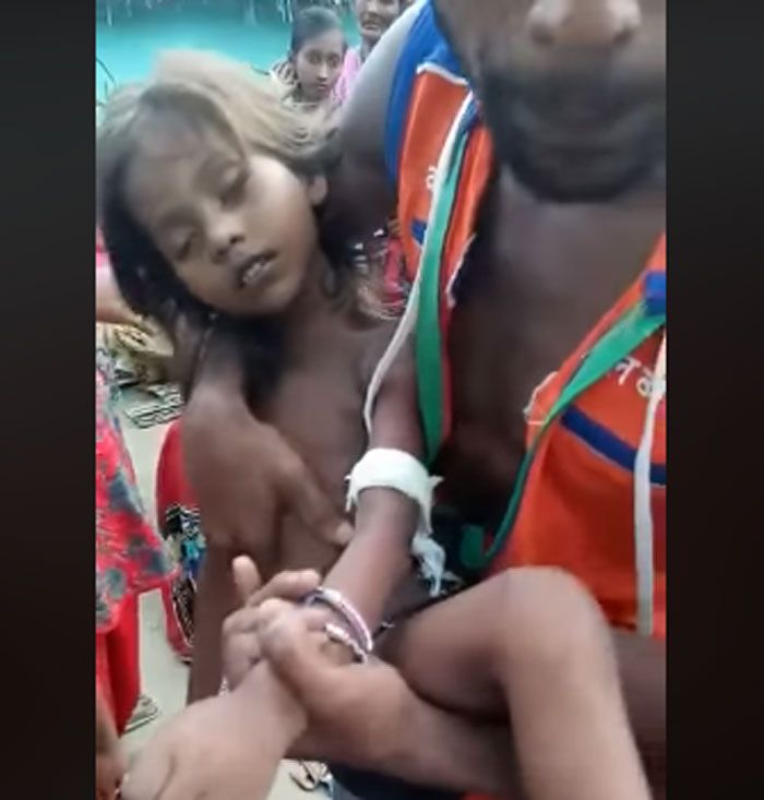 बच्ची के पिता अमरेंद्र कैमरे पर सिमरन के हाथ में बंधी पट्टी दिखा रहे हैं. पुलिस का भी कहना है कि परिवार पढ़ा-लिखा है. उन्होंने अपनी तरफ से सतर्कता बरती थी. सांप काटने की स्थिति में जरूरी प्राथमिक बातों का ध्यान रखा था.