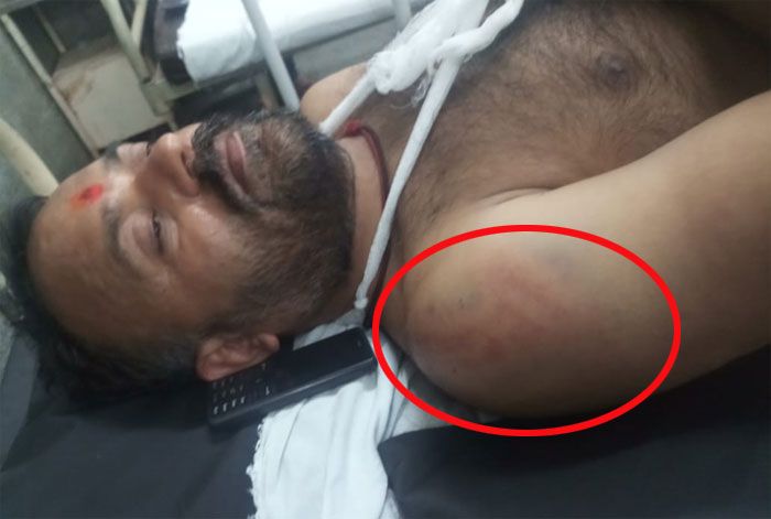 कई कांग्रेसी नेताओं को चोट आई है. कुछ का सिर भी फूटा है. घायलों में महिलाएं भी शामिल हैं (फोटो: The Lallantop)