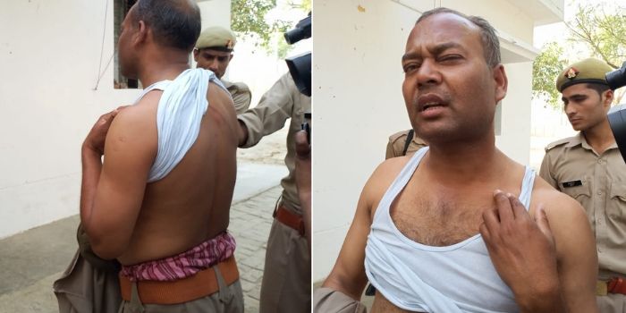 मीडिया कर्मियों को अपने शरीर की चोट दिखाते दरोगा