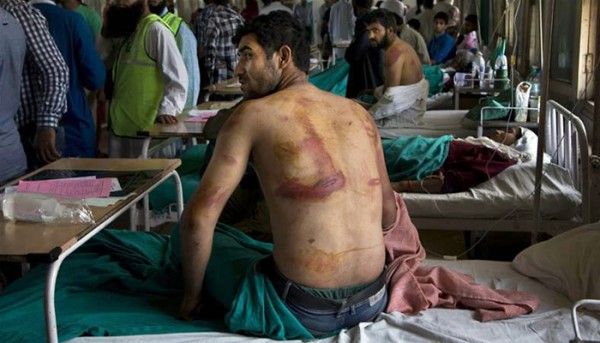 पुलिस के ऊपर ज्यादती के कई आरोप लगते आए हैं. लेकिन इन मामलों में डीटेल हमेशा बाहर नहीं आ पाती. तस्वीर: AP 