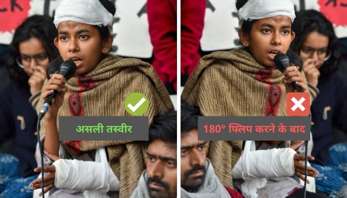 हमने एक ही तस्वीर को दो तरह से दिखाया है. असली तस्वीर में दिख रहा है कि आइशी का दाहिना हाथ टूटा है. लेकिन जब फोटो को 180 डिग्री पलटने पर बिल्कुल उलट तस्वीर बन गई. 