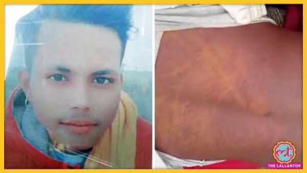 बाएं- मृतक राहुल, दाएं- किशोर के शरीर पर पिटाई के निशान (साभार: ट्विटर) बाएं- मृतक राहुल, दाएं- किशोर के शरीर पर पिटाई के निशान (साभार ट्विटर)