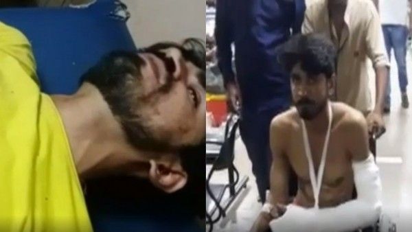 Accused Got Injured